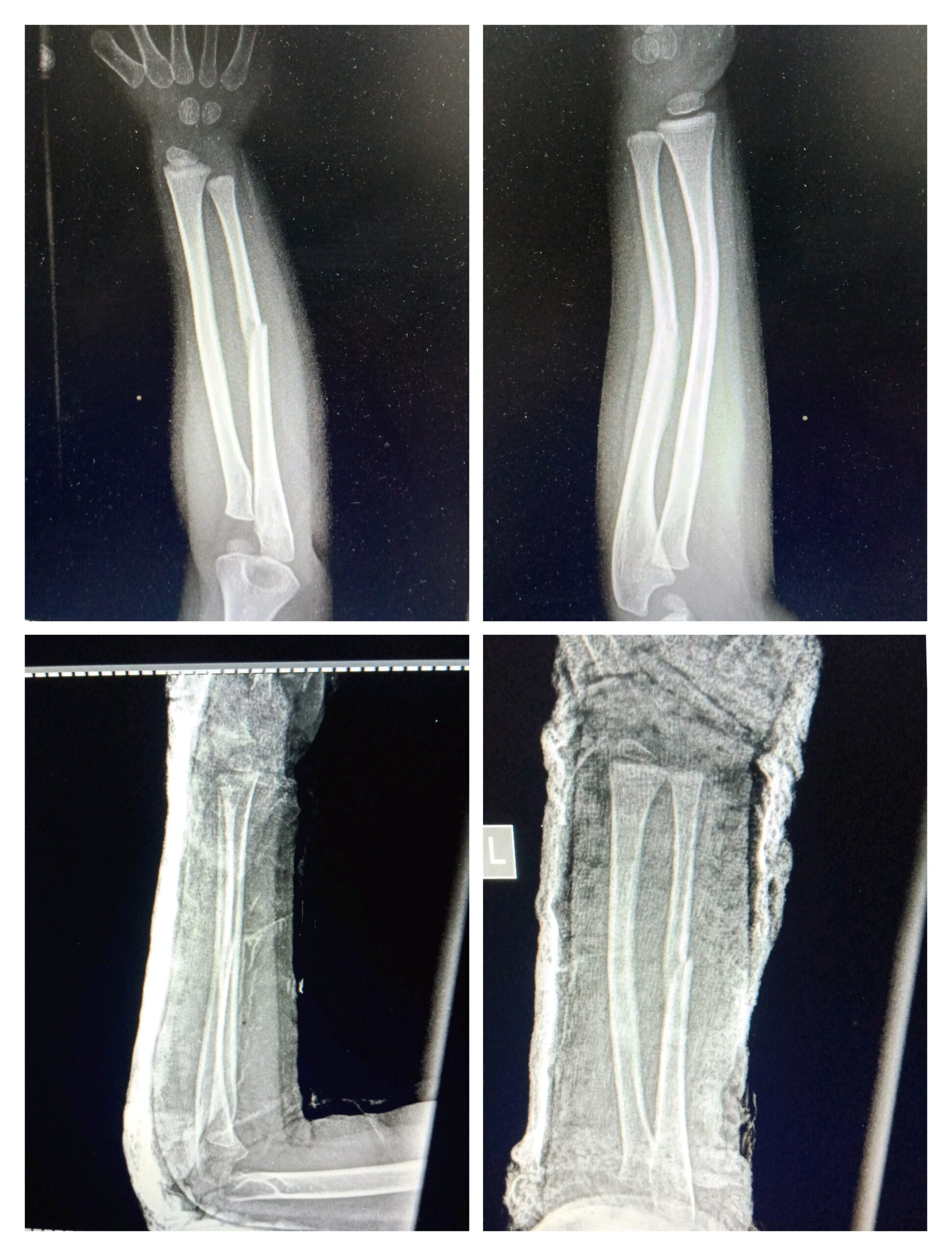 IMG 20250716 182323 Scaled